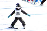X314